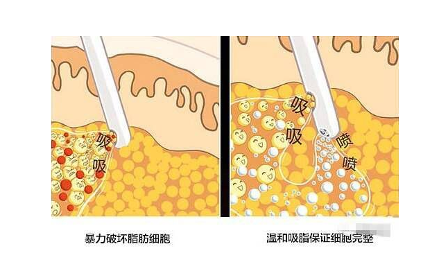 /Public/ueditor/php/upload/image/20190127/1548575936302320.png
