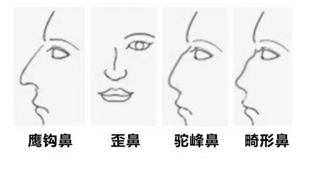 /Public/ueditor/php/upload/image/20190128/1548658698327782.png