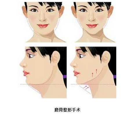 /Public/ueditor/php/upload/image/20190130/1548840247311577.png