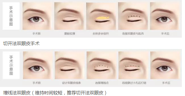/Public/ueditor/php/upload/image/20190202/1549100106316654.png