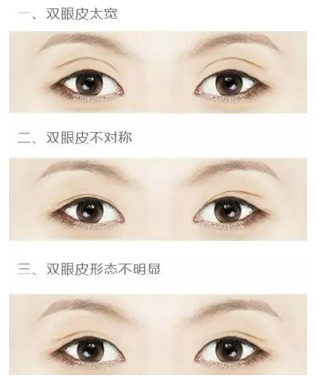 /Public/ueditor/php/upload/image/20190202/1549100161232777.png