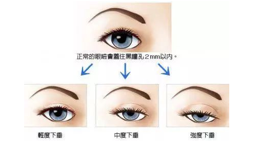 /Public/ueditor/php/upload/image/20190202/1549100183499047.png