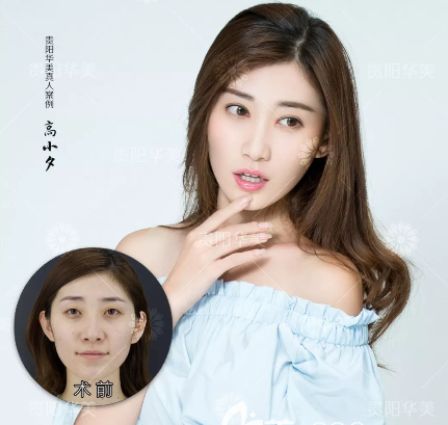 /Public/ueditor/php/upload/image/20190220/1550646711329910.png