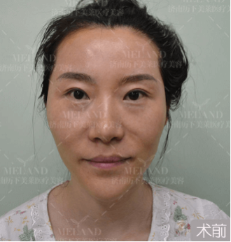 /Public/ueditor/php/upload/image/20190228/1551338343464927.png