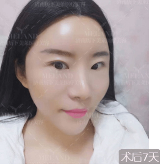 /Public/ueditor/php/upload/image/20190228/1551338366158538.png