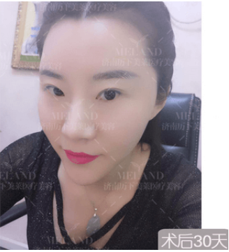 /Public/ueditor/php/upload/image/20190228/1551338389427862.png