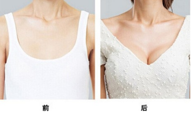 /Public/ueditor/php/upload/image/20190228/1551339495243349.png