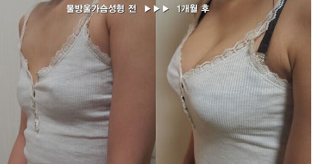 /Public/ueditor/php/upload/image/20190228/1551341739686057.png