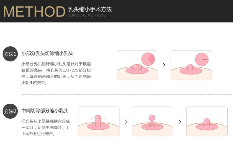 /Public/ueditor/php/upload/image/20190307/1551944702553217.png