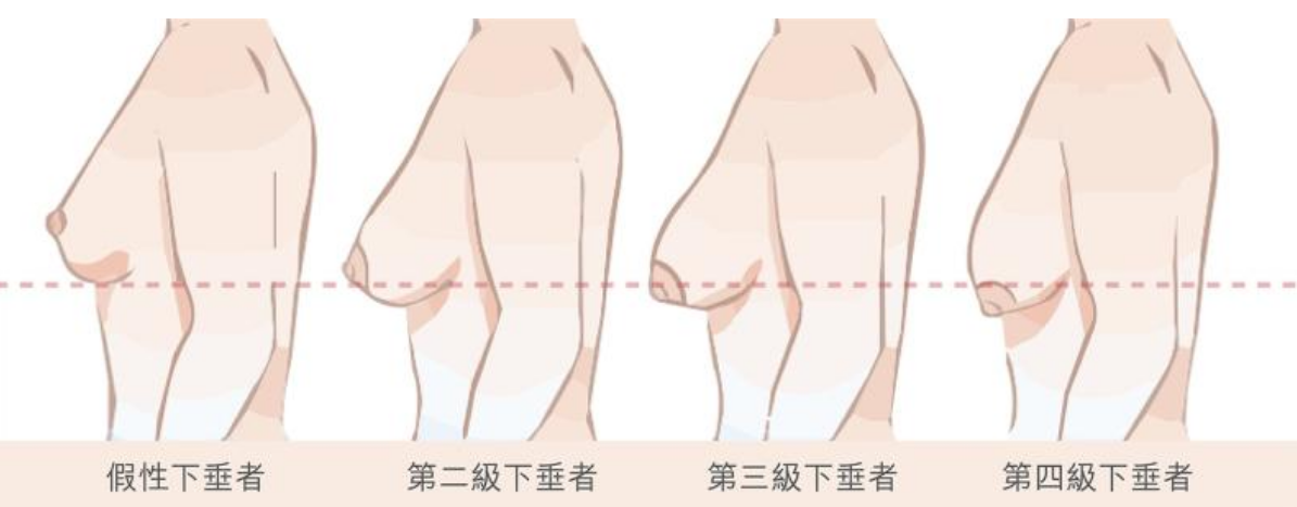 /Public/ueditor/php/upload/image/20190308/1552026091575852.png