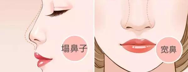 /Public/ueditor/php/upload/image/20190309/1552118514484659.jpg