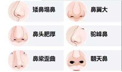 /Public/ueditor/php/upload/image/20190313/1552467251750196.jpg
