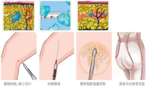 /Public/ueditor/php/upload/image/20190314/1552553421361553.png
