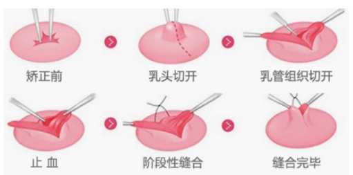 /Public/ueditor/php/upload/image/20190315/1552639465995628.png