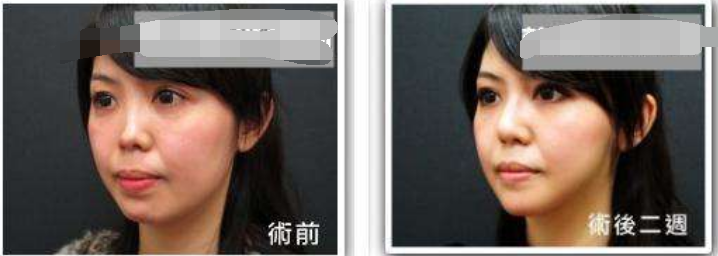 /Public/ueditor/php/upload/image/20190318/1552892102588482.png