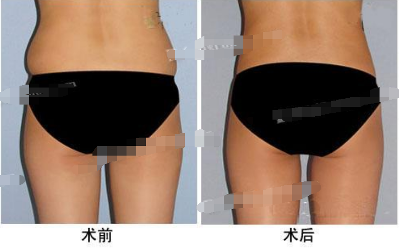 /Public/ueditor/php/upload/image/20190324/1553413172804248.png