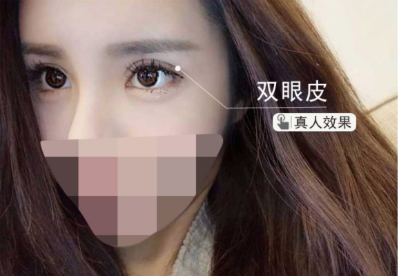 /Public/ueditor/php/upload/image/20190325/1553483784921033.png