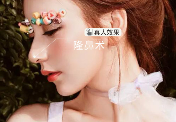 /Public/ueditor/php/upload/image/20190325/1553483822592583.png