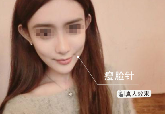 /Public/ueditor/php/upload/image/20190325/1553483836983966.png