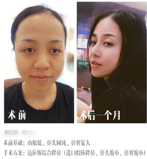 /Public/ueditor/php/upload/image/20190325/1553495221255600.png