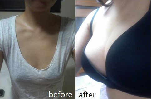 /Public/ueditor/php/upload/image/20190327/1553676766157421.png