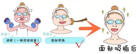 /Public/ueditor/php/upload/image/20190403/1554277777448247.jpg
