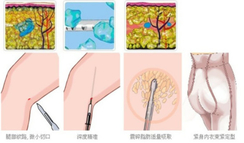 /Public/ueditor/php/upload/image/20190404/1554368871343694.png