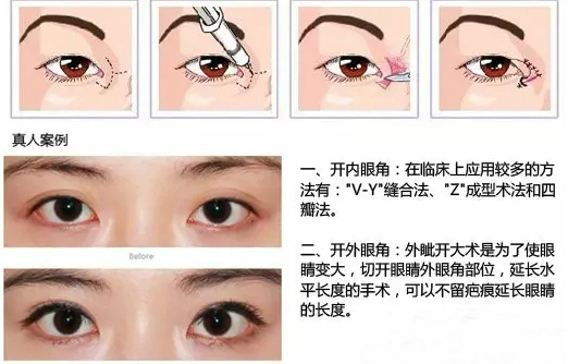 /Public/ueditor/php/upload/image/20190410/1554868539397335.png