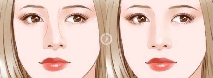 /Public/ueditor/php/upload/image/20190410/1554878873703198.png