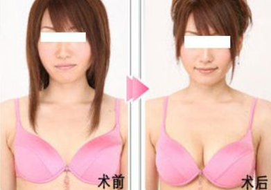 /Public/ueditor/php/upload/image/20190411/1554966498510071.png