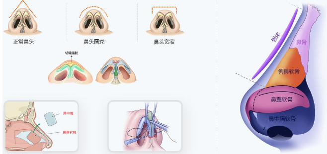 /Public/ueditor/php/upload/image/20190411/1554968141954684.png