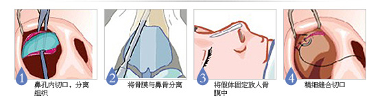/Public/ueditor/php/upload/image/20190412/1555048689345057.png