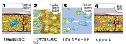 /Public/ueditor/php/upload/image/20190412/1555049933941575.png