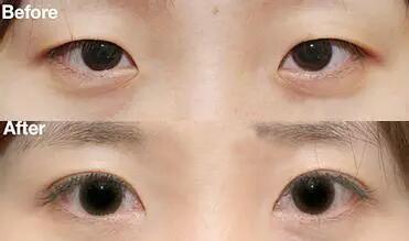 /Public/ueditor/php/upload/image/20190412/1555055601407724.jpg