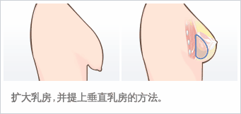 /Public/ueditor/php/upload/image/20190413/1555142376498599.jpg