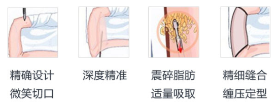 /Public/ueditor/php/upload/image/20190414/1555229939979824.png