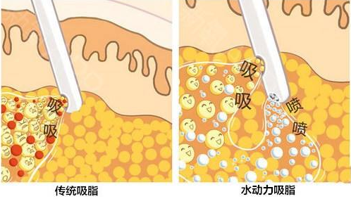 /Public/ueditor/php/upload/image/20190414/1555230063957792.png