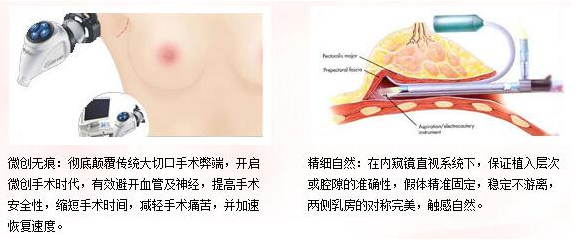/Public/ueditor/php/upload/image/20190414/1555233798527288.png
