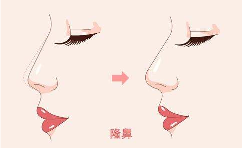 /Public/ueditor/php/upload/image/20190415/1555316648518843.png