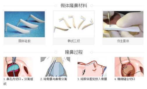 /Public/ueditor/php/upload/image/20190415/1555318235225974.png