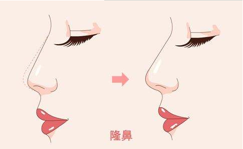 /Public/ueditor/php/upload/image/20190415/1555319183825471.png