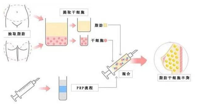 /Public/ueditor/php/upload/image/20190416/1555397502318632.png