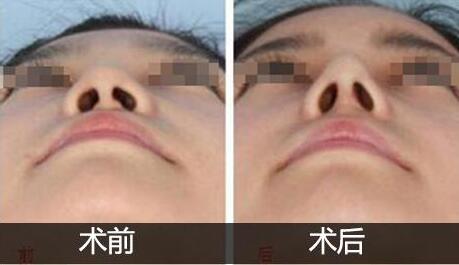 /Public/ueditor/php/upload/image/20190416/1555401920211717.jpg