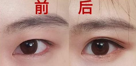 /Public/ueditor/php/upload/image/20190423/1556007353395895.png