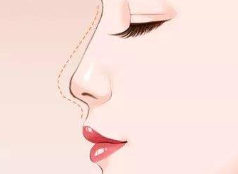 /Public/ueditor/php/upload/image/20190424/1556078398932706.png