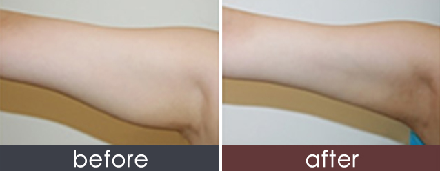 /Public/ueditor/php/upload/image/20190425/1556181076290070.png