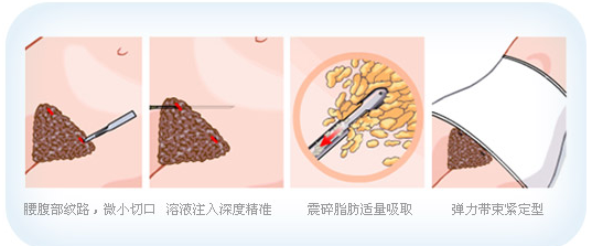 /Public/ueditor/php/upload/image/20190425/1556183772832191.png