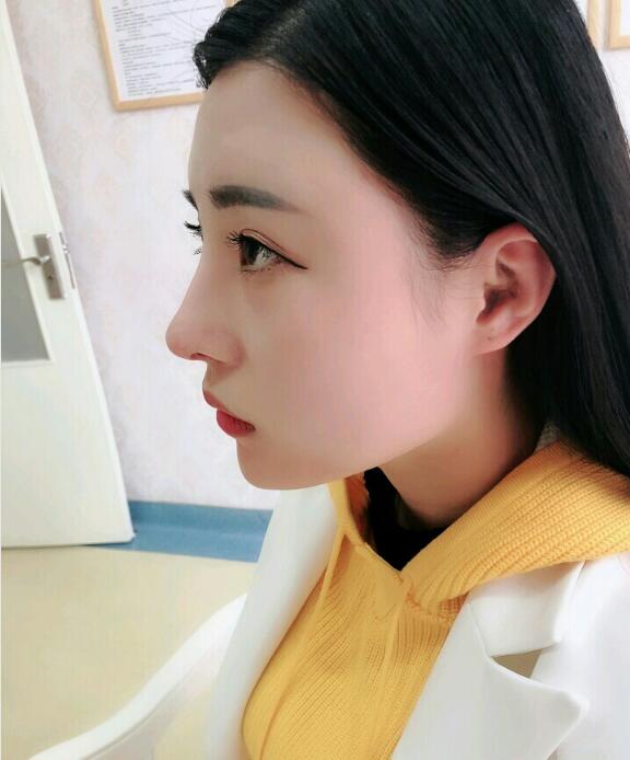 /Public/ueditor/php/upload/image/20190425/1556185238342093.jpg