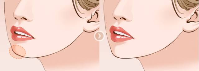 /Public/ueditor/php/upload/image/20190429/1556526729949408.jpg