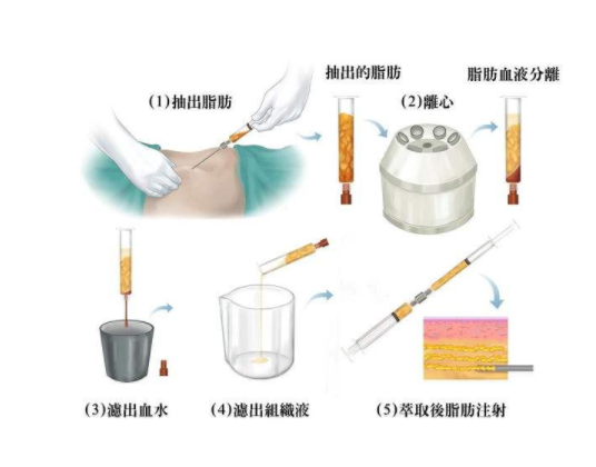 /Public/ueditor/php/upload/image/20190429/1556529561889666.png